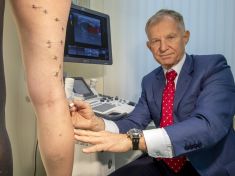 Křečovým žilám se nedá uniknout, v léčbě je ale možné téměř vše. A bezbolestně