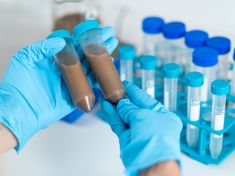 V Česku můžete darovat svou vlastní stolici. Získáte za to 5 000 Kč a dobrý pocit