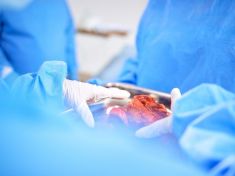 Na orgány čekají až stovky pacientů. Rizika pro dárce jsou minimální, říká lékař