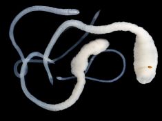 Paraziti v těle nejsou mýtus. Které nemoci způsobují a jak se jich zbavit