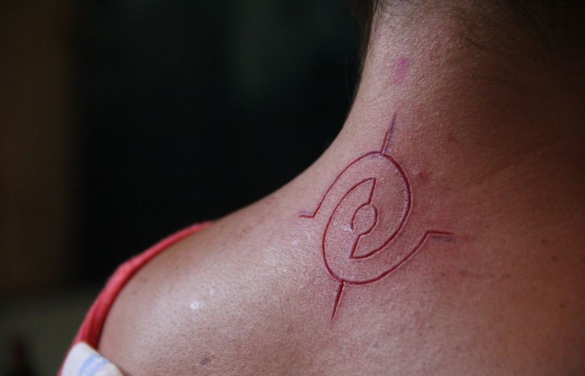 Tattoopunktura spojuje tetování a akupunkturu. Pozitivní účinky jsou překvapivé, říká odborník