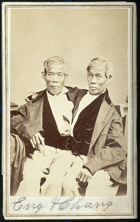 512px chang and eng conjoined twins seated. photograph c. 1860. wellcome v0029573