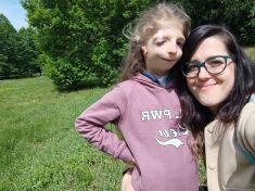 Mezinárodní týden rovnosti tváří: Fyzická odlišnost neznamená mentální hendikep