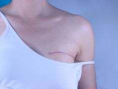 Jak žít s onkologickou diagnózou a po ní: Rakovina patří k životu, říká radiolog