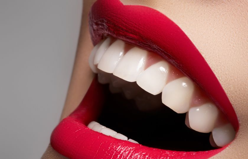 Všechno, co potřebujete vědět o bělení zubů. Jedlou sodou to nezkoušejte, varuje zubařka