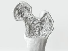 Křehké kosti ke stáří patřit nemusí. Na mléko ale zapomeňte