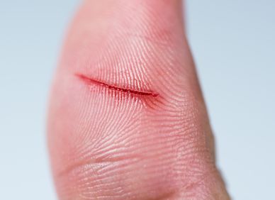 Z malé ranky do márnice. Jak se z nevinného poranění stává boj o život