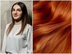 S řídnoucími a padajícími vlasy pomohou nové technologie. Terapie však není pro každého 