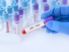 Začíná roztroušená skleróza roky před prvními příznaky? V podezření je známý virus