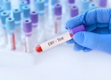 Začíná roztroušená skleróza roky před prvními příznaky? V podezření je známý virus