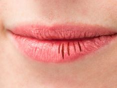 Ozempicový úsměv. Sucho, zápach a problémy, které zaskočí i spokojeně hubnoucí