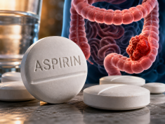 Lék, který má doma každý, může brzdit návrat rakoviny střeva. Ale jen u některých pacientů