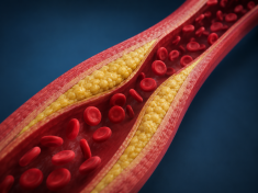 Vyšší cholesterol může znamenat delší život. Jenže ne pro každého