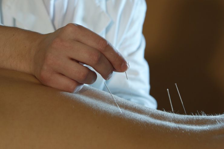 akupuntura.jpg