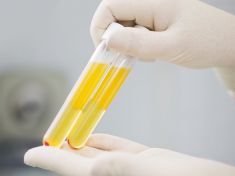 Budeme se léčit kokosy namísto krevní plazmy? 