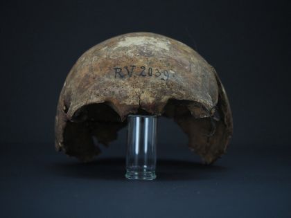 Nejstarší známá oběť moru: Nemoc byla v DNA lovce, který zahynul před 5 000 lety