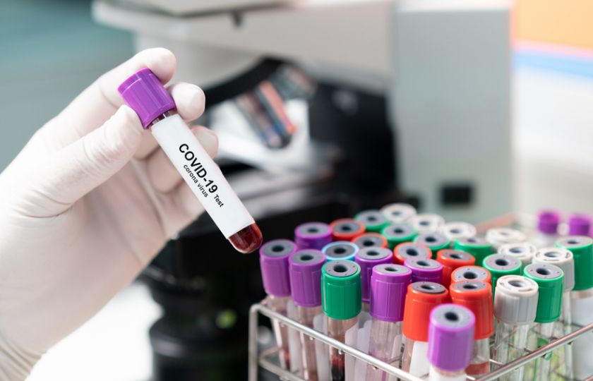 Vídeňští vědci vynalezli jednoduchý test na koronavirus. Ten pozitivní je světle modrý