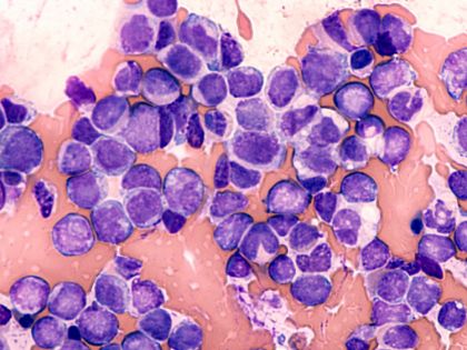 Výzkumníkům je k dispozici nový Atlas lidské patologie. Mohou údaje pomoci při léčbě rakoviny? 
