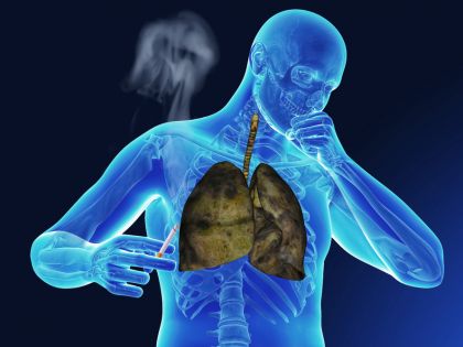 Jak poznat, kdy už nejde o kašel, ale chronickou plicní nemoc