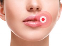 Jak vyzrát na opary? Jednoduše díky těmto potravinám