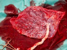 Prosím, můžete už konečně přestat jíst placentu!