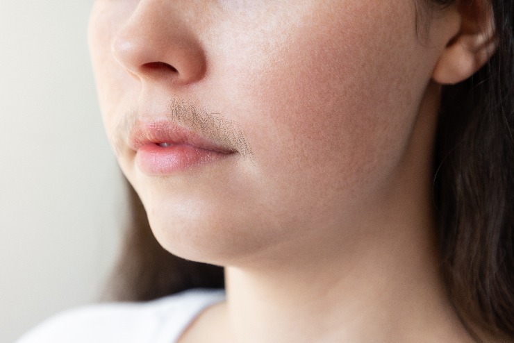 Na množství a sílu chloupků v obličejí má vliv genetika - ne to, jak je odstraňujete. m shutterstock 2130212441