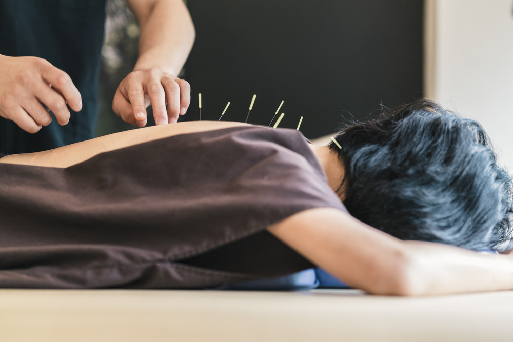 Tradiční čínská medicína může skvěle doplňovat tu západní shutterstock 557356975
