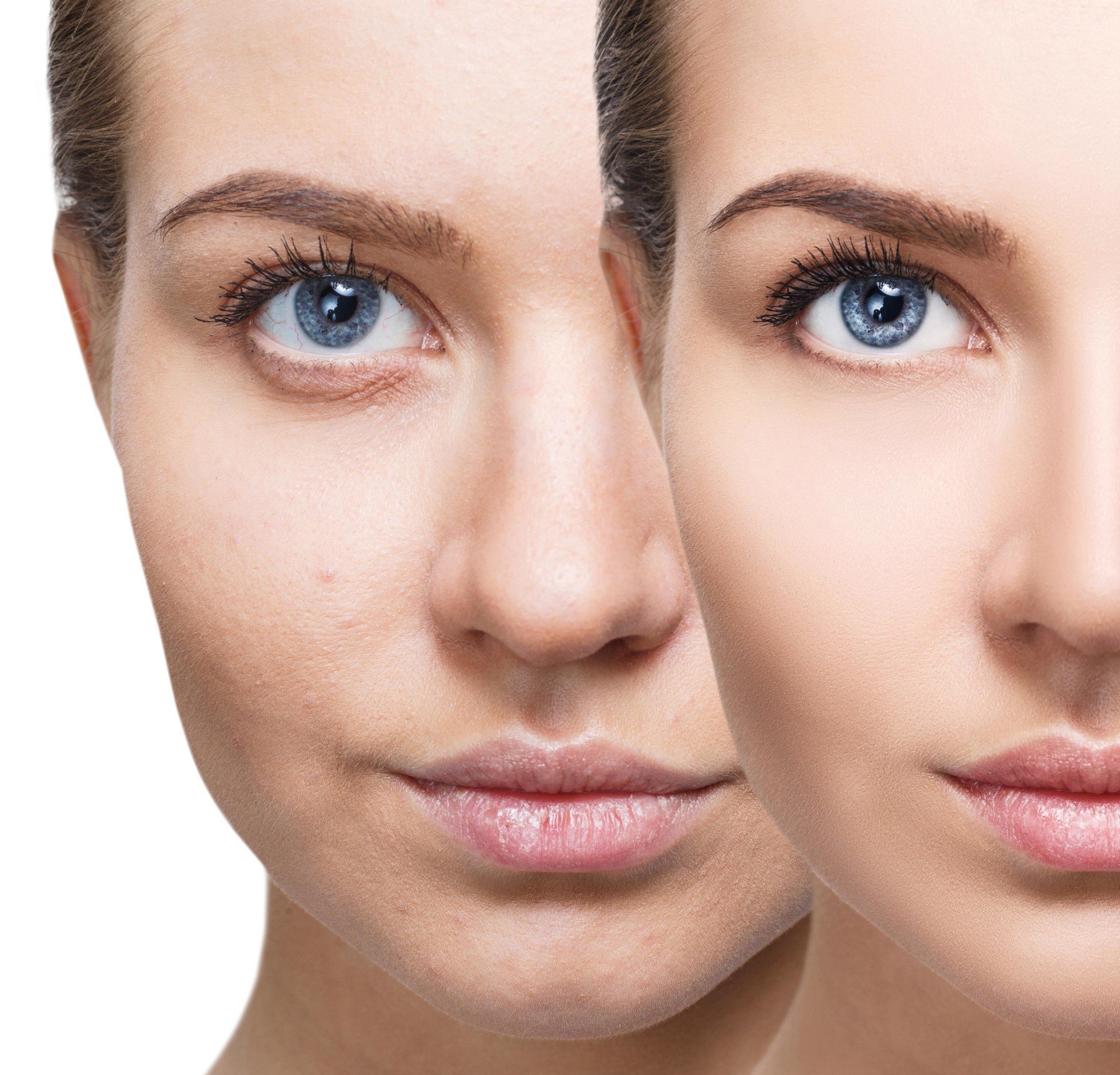 Face app Díky telefonu jsme krásnější. Ovšem jen v telefonu Flowee