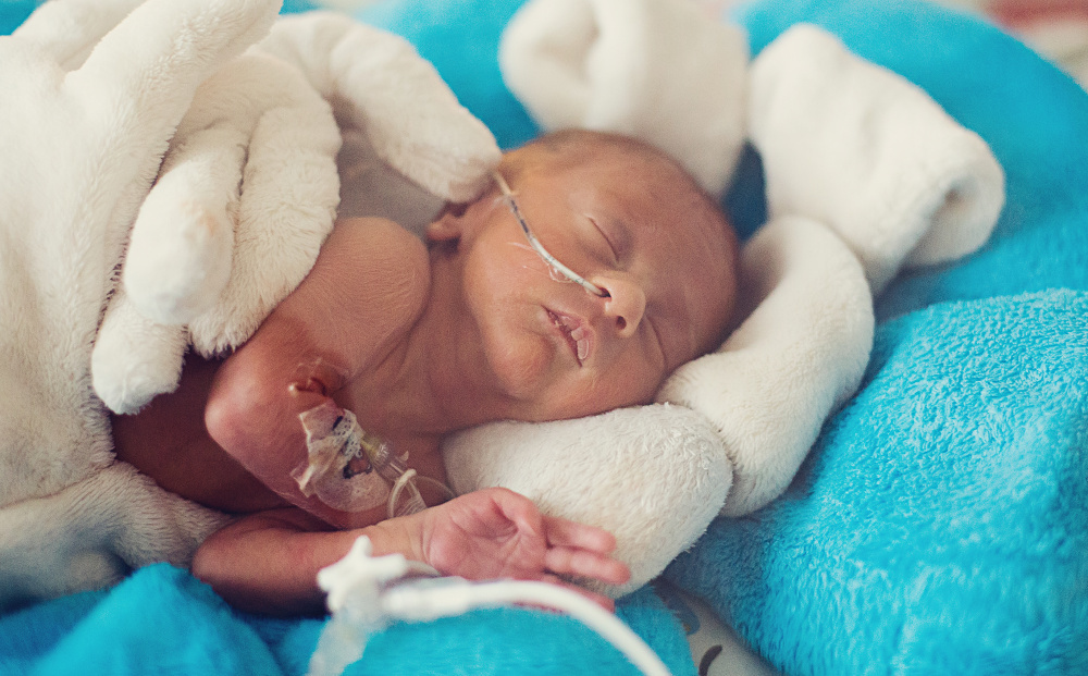Dodnes si pamatuji, jak mě děsilo pípání a houkání monitorů, které alarmovaly poklesy při dýchání, vzpomíná Hanka. Zdroj foto: Se svolením Hany Píšové mimi
