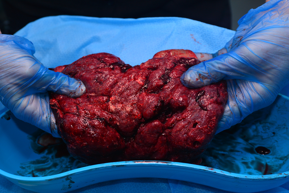 Jakkoliv to zní neuvěřitelně, na internetu naleznete i spoustu receptů, jak placentu uvařit. placenta shutterstock 200194118